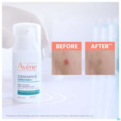Avene Cleanance Comedomed Gel-cre Konzentrat 30ml, A-Nr.: 5228334 - 04