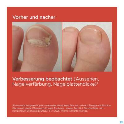 Sie sehen eine Packung Isdin Si-nails Micoxpert 4,5ml, Produktbild: 09 Isdin Si-nails Micoxpert 4,5ml, A-Nr.: 5744952 - 09
