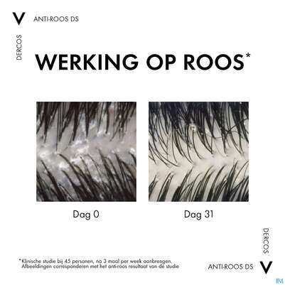 Shampoon Vichy/dercos Anti-schuppen Pflege Trockenes Haar Neu 200ml, A-Nr.: 4357414 - 22