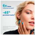 Ducray Keracnyl Pp+ Creme Gegen Hautunreinheiten 30ml, A-Nr.: 5564397 - 19