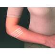 Nexcare™ Steri-Strip™ Wundverschlussstreifen, assortiert, 8/Packung, A-Nr.: 5717406 - 02